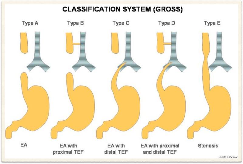 Classification System